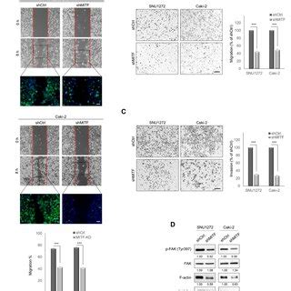 Mitf Knockdown Suppresses Cell Migration And Invasion In Vitro A