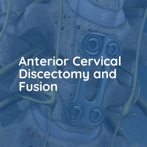 Anterior Cervical Discectomy And Fusion