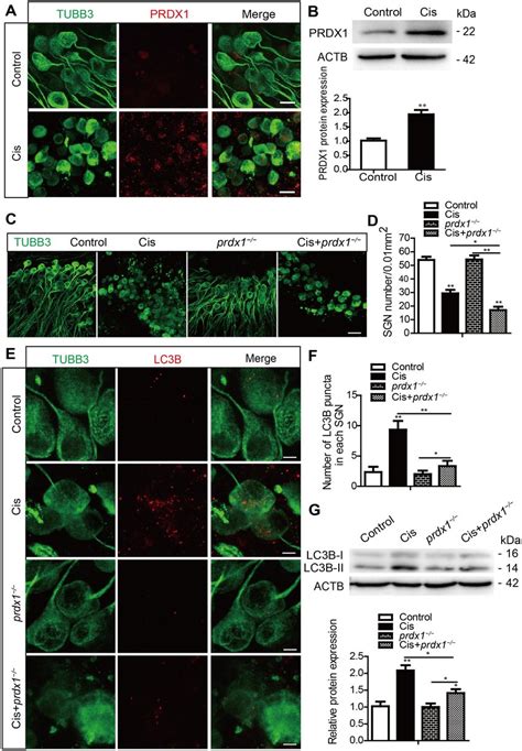 Prdx Is Activated And Regulates The Autophagy Activity In Sgns After