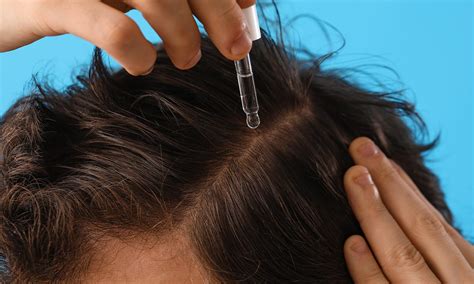 5 Rekomendasi Serum Penumbuh Rambut Paling Ampuh 2023