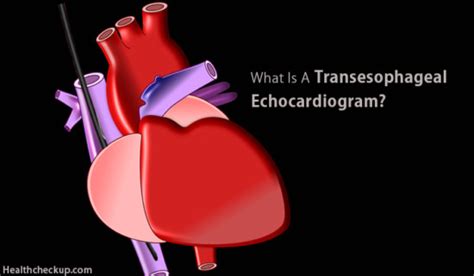 Transesophageal Echocardiogram(TEE) - Preparation, Procedure, Views ...