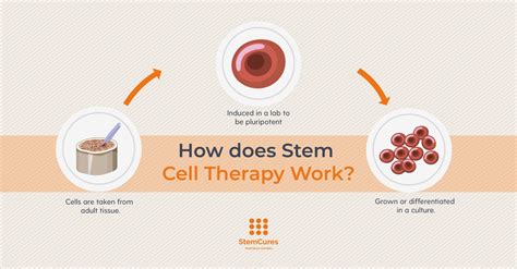 Stem Cell Therapy And What It Can Treat StemCures