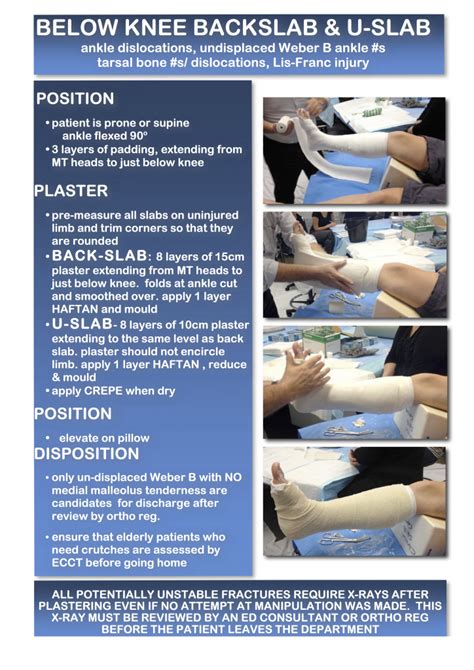 Cme 22514 Plaster Tips And Guides Charlies Ed