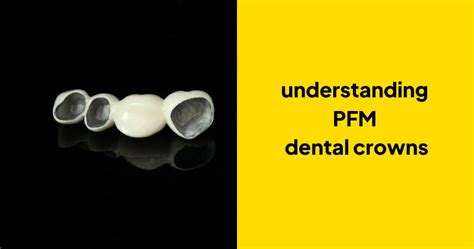 Understanding Pfm Dental Crowns A Comprehensive Guide