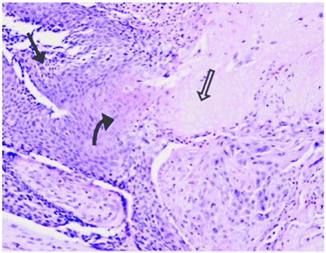 Hematoxylin And Eosin Stained Histologic Section At 400 Magnification