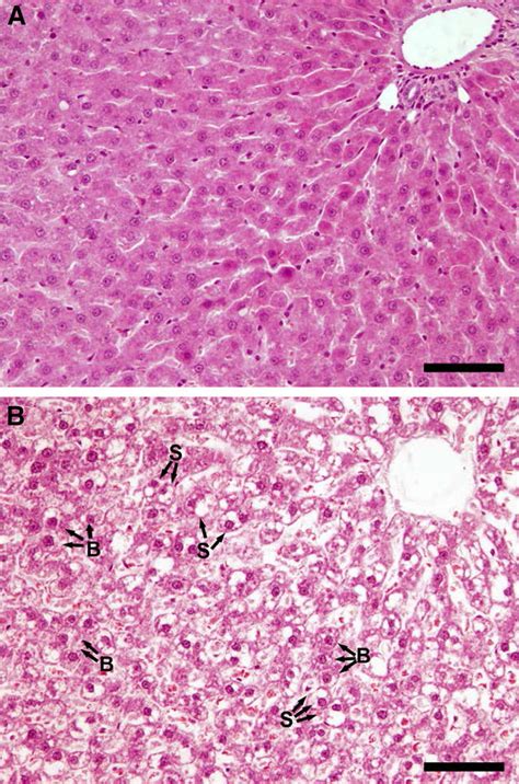 Histological Analysis Of The Liver Hematoxylineosin Staining Of Ct A