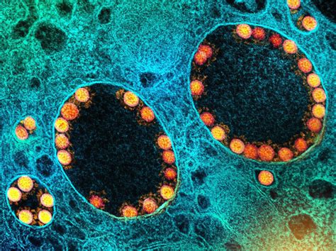 SARS CoV 2 Variants Of Concern Exhibit Divergent Interactions With Host