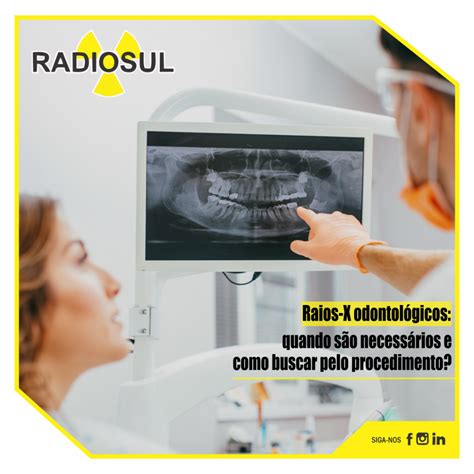 Radiosul Digital Raios X Odontol Gicos Quando S O Necess Rios E Como