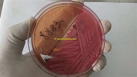 Lactose Fermenter Lf And Non Lactose Fermenter Nlf Gram