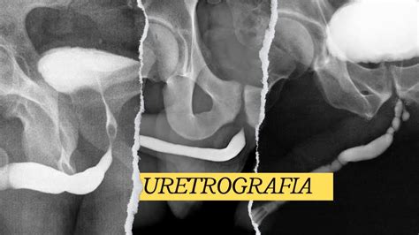 URETROGRAFIA | ESTUDIO RADIOLÓGICO #radiologia #radiology #anatomia ...