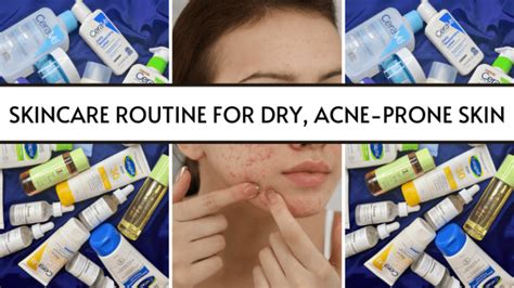 The Only Skincare Routine For Dry Acne Prone Skin That Works