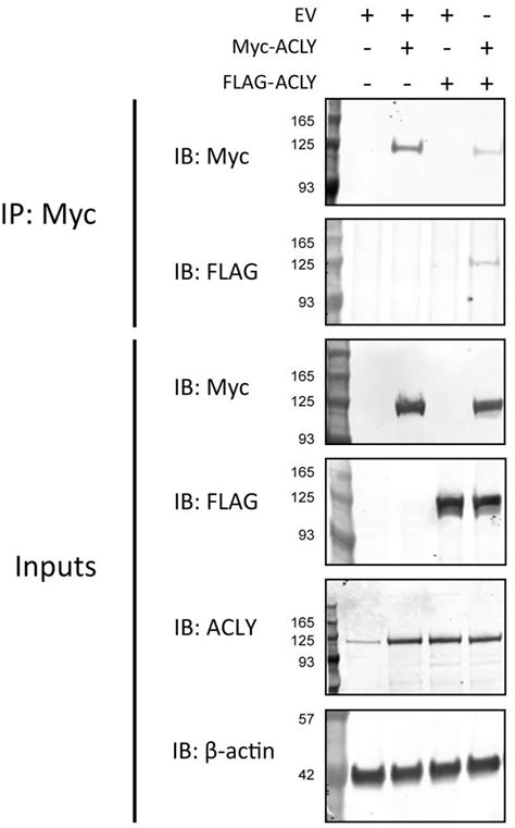 Western Blotting Analysis Of Ectopic ACLY FL Co IP In HEK293T Cells