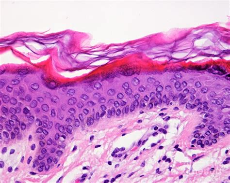 Skin Epidermis Photograph By Jose Calvo Science Photo Library