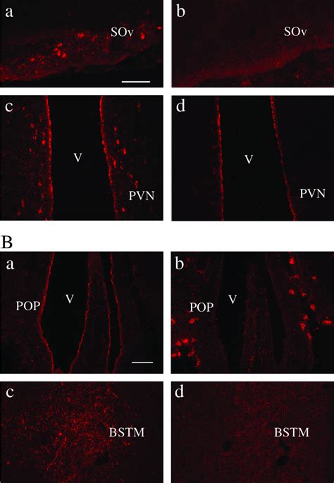 A Photomicrographs Demonstrating Mt Ir Neurons In The Sov A B And