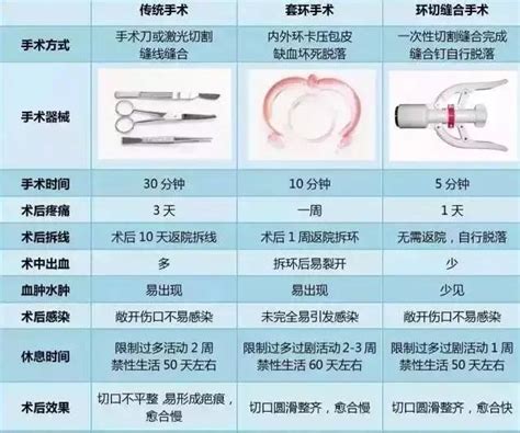 割包皮的好选择