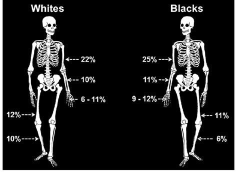 Schematic Mapping Out The Sex Differences In Cortical Area For Blacks