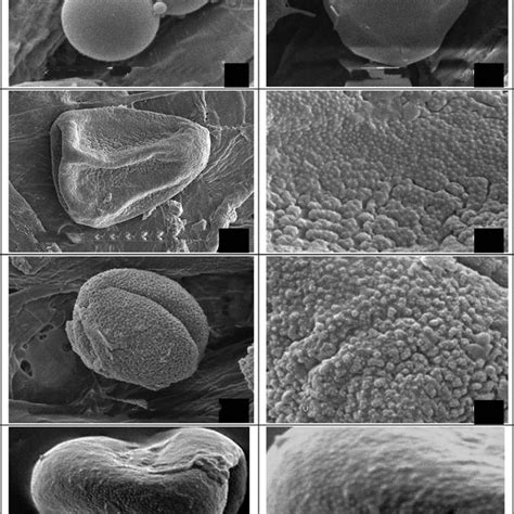 Fig Ure 5 Sem Pollen Micrograph Of Cyperus Flavescens 1 2 Cyperus Download Scientific