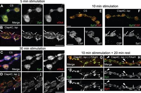 Ultrastructural analysis of synaptic boutons following acute... | Download Scientific Diagram