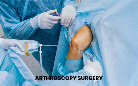 Comprehensive Arthroscopy Shoulder Knee Wrist And More Doctorsapp