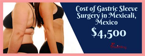 Affordable Package For Gastric Sleeve In Mexicali Mexico At 4500