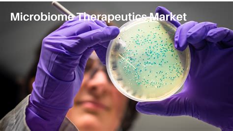 Microbiome Therapeutics Market Size, Growth and Forecast 2030