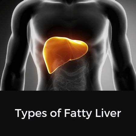 11 Best Fatty Liver Stages images | Fatty liver, Fatty, Liver