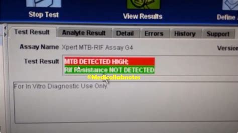 Genexpert Test For Tuberculosis Introduction Principle Test