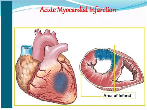 Cardiac Emergencies Ppt