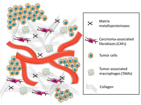 Matrix Factor Cancer