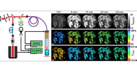 Label Free Metabolic Imaging In Vivo By Two Photon Fluorescence