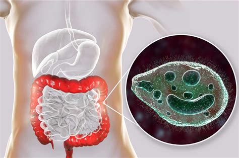 ¿qué Son Los Parásitos Intestinales Y Qué Nos Causan Fundación Best