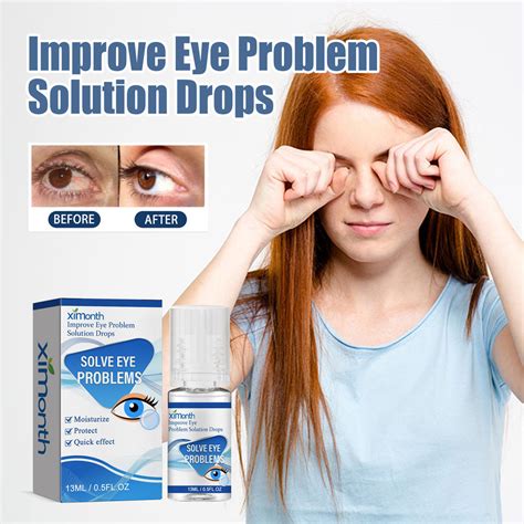 Myopia Eye Drops Relieve Eye Fatigue Soreness Redness And Swelling Blurred Vision Gentle Eye