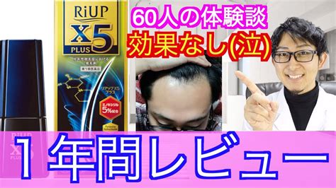 【育毛剤•aga対策】リアップx5は効果あるの？agaの60人の体験談を元にリアルガチで解説します Youtube