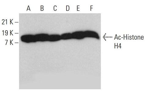 Ac Histone H E Scbt Santa Cruz Biotechnology