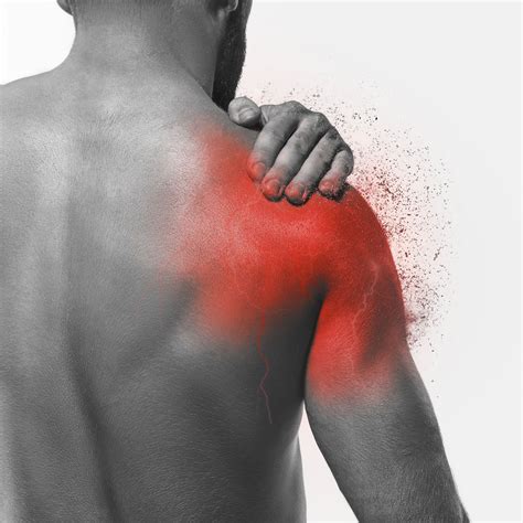 Tendinitis En El Hombro Clínica Physis