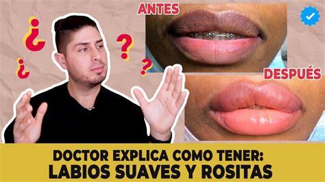 C Mo Aclarar Tus Labios Obscuros Doctor Lemus Youtube