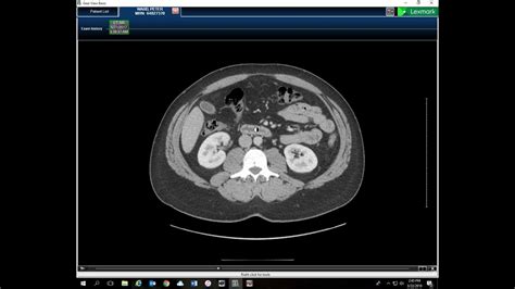 Ct Pelvis Anatomy Anatomical Charts And Posters