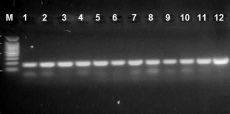 Agarose Gel Electrophoresis Image Showing The Pcr Product Of 16s Rrna