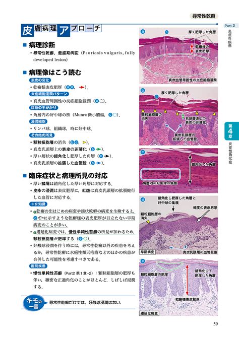 病理像＋臨床写真で一目でわかる！ 臨床医が知っておきたい皮膚病理の見かたのコツ 羊土社