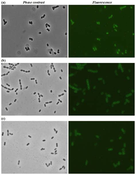 Phase Contrast And Fluorescence Microscopy Of L Lactis Nz Cells