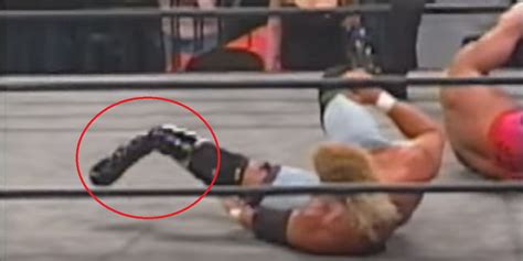 Top 15 Real Wrestling Injuries That Were Hard To Watch