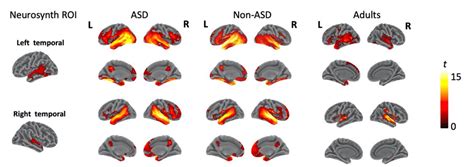 Whole Brain Intrinsic Functional Connectivity Maps For Asd Non Asd