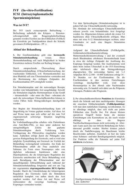 IVF In Vitro Fertilisation ICSI Intrazytoplasmatische Wunschkind EV