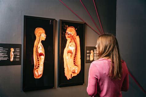 Berlin Tickets For The Body Worlds Museum In Berlin Getyourguide