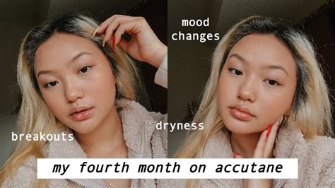 My Accutane Journey Month 4 Youtube