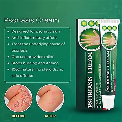 Skinmedix Psoriasis Cream G Natural Chinese Herbal Eczema Treatment