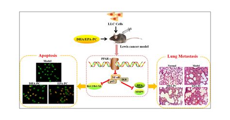 Dha Epa Enriched Phosphatidylcholine Suppresses Tumor Growth And