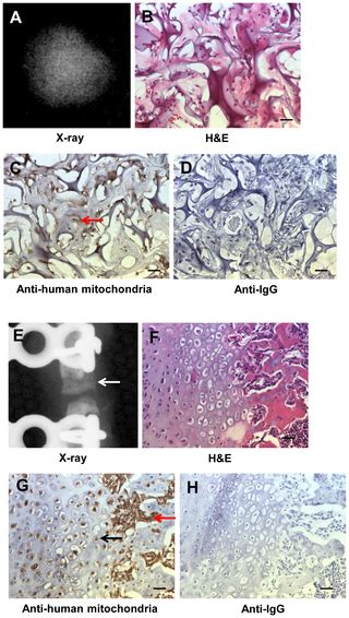 Cd146 Human Umbilical Cord Perivascular Cells Maintain Stemness Under