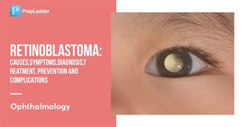 Retinoblastoma Causes Symptoms Diagnosis Treatment Prevention And