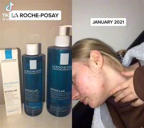 La Roche Posay Effaclar 3 Step Anti Blemish System In 2024 La Roche Posay Skin Care Routine